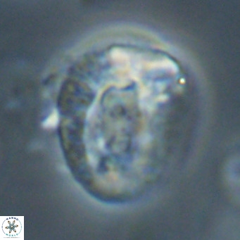 Helicosphaeroides lophotes VR 31190