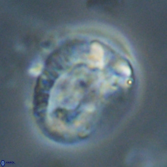 Helicosphaeroides lophotes VR 31191