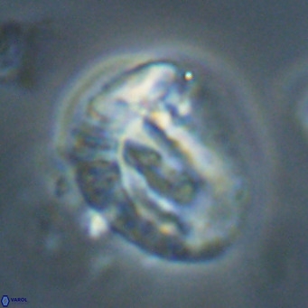 Helicosphaeroides lophotes VR 31192