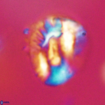 Helicosphaeroides lophotes VR 31193