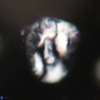 Helicosphaeroides lophotes VR 31194