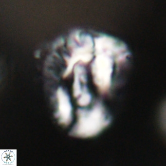 Helicosphaeroides lophotes VR 31194