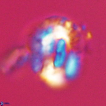 Helicosphaeroides lophotes VR 31196