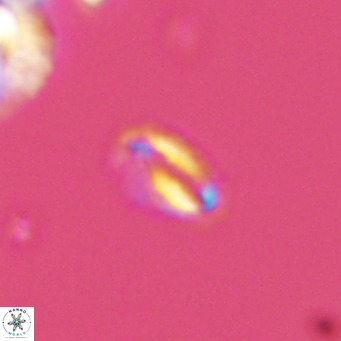 Helicosphaeroides mullerae VR 09897
