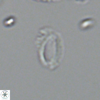 Helicosphaeroides mullerae VR 09905