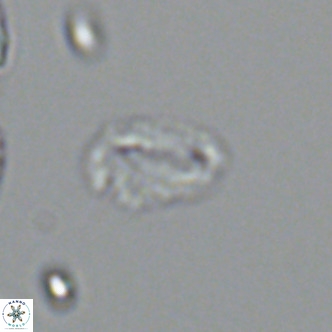 Helicosphaeroides mullerae VR 09908