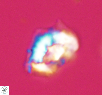 Helicosphaeroides reticulata VR 32906