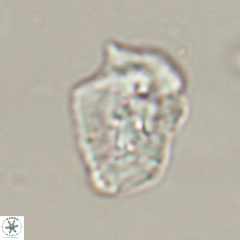 Helicosphaeroides reticulata VR 32909