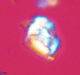 Helicosphaeroides reticulata VR 32902