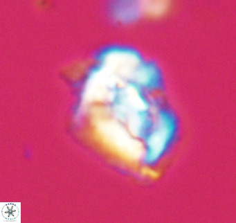 Helicosphaeroides reticulata VR 32902