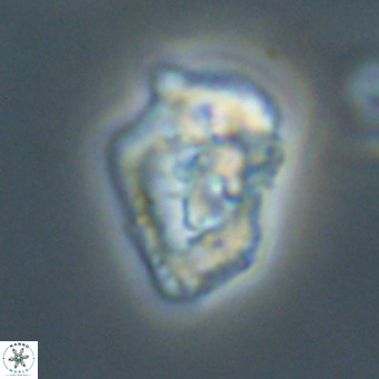 Helicosphaeroides reticulata VR 32915