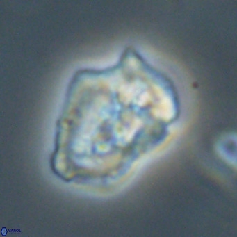 Helicosphaeroides reticulata VR 32916