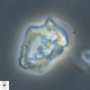 Helicosphaeroides reticulata VR 32916