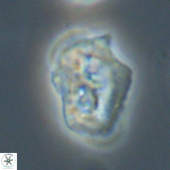 Helicosphaeroides reticulata VR 32918