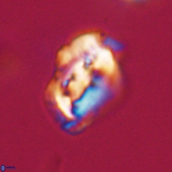 Helicosphaeroides reticulata VR 32925