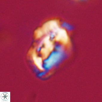 Helicosphaeroides reticulata VR 32925