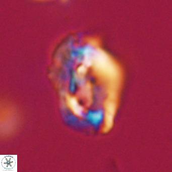 Helicosphaeroides reticulata VR 32929