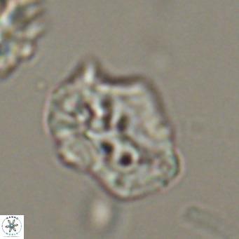 Helicosphaeroides reticulata VR 32920