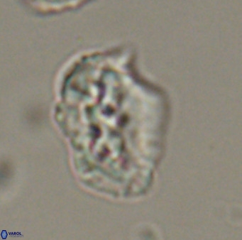 Helicosphaeroides reticulata VR 32922