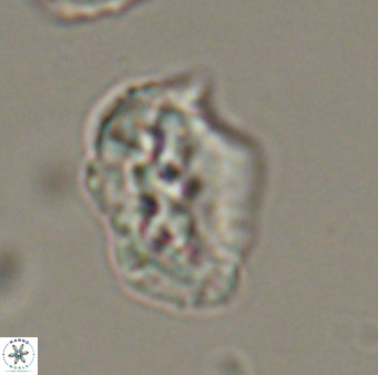 Helicosphaeroides reticulata VR 32922