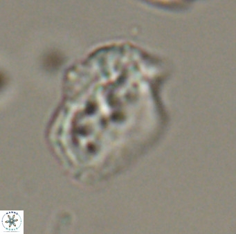 Helicosphaeroides reticulata VR 32923