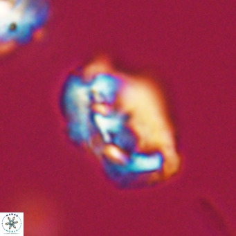 Helicosphaeroides reticulata VR 32930