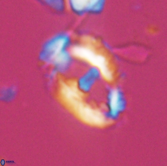 Helicosphaeroides seminulum 25847