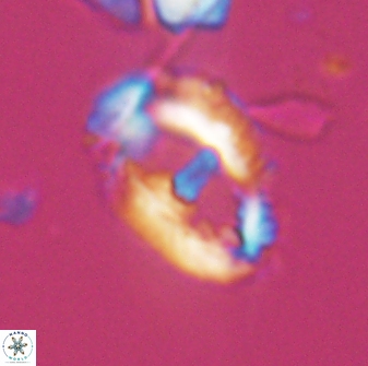 Helicosphaeroides seminulum 25847