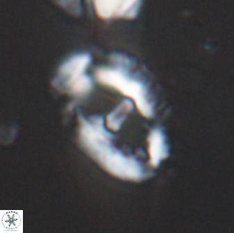Helicosphaeroides seminulum 25848