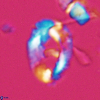 Helicosphaeroides seminulum 25851