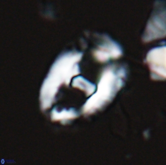 Helicosphaeroides seminulum 25853