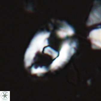 Helicosphaeroides seminulum 25853