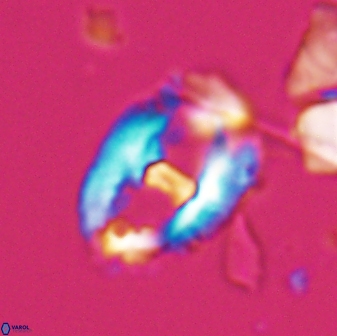 Helicosphaeroides seminulum 25854