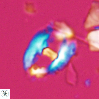 Helicosphaeroides seminulum 25854