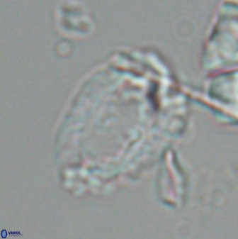 Helicosphaeroides seminulum 25855