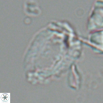 Helicosphaeroides seminulum 25855