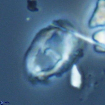 Helicosphaeroides seminulum 25857