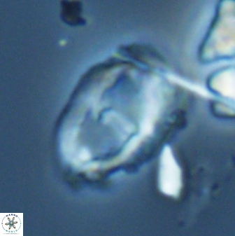 Helicosphaeroides seminulum 25857