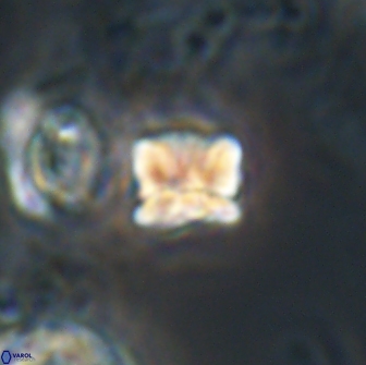 Heliolithus aktasii 20984