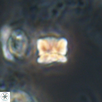 Heliolithus aktasii 20984