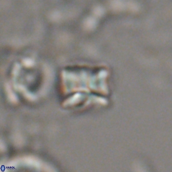 Heliolithus aktasii 20983