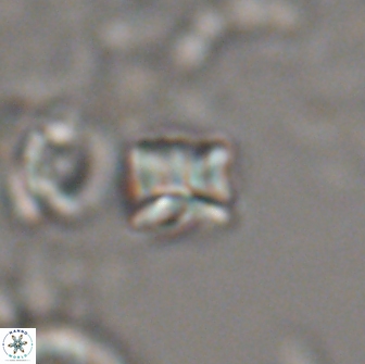 Heliolithus aktasii 20983