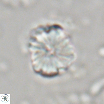 Heliolithus aktasii 21084