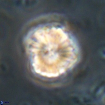 Heliolithus aktasii 21087