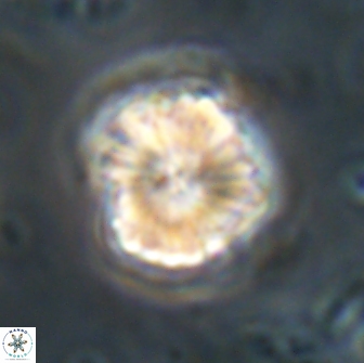 Heliolithus aktasii 21087