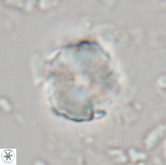 Heliolithus aktasii 21083