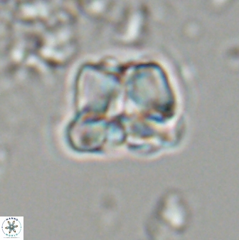 Heliolithus aktasii 22394