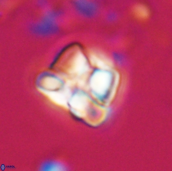 Heliolithus aktasii 22393