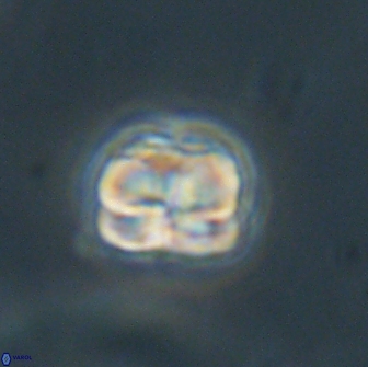 Heliolithus aktasii 66525