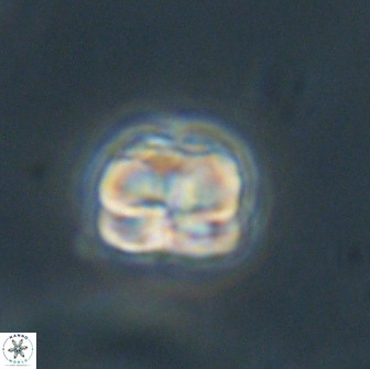 Heliolithus aktasii 66525